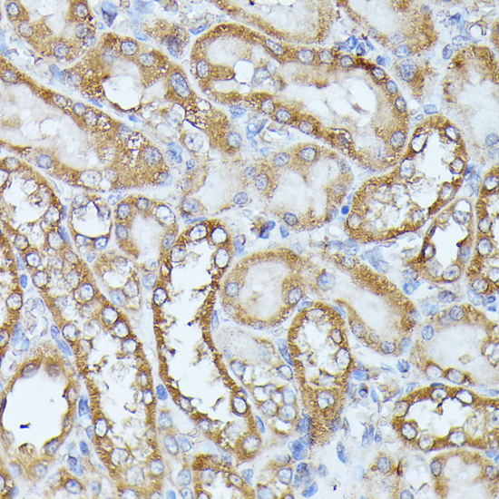 Immunohistochemistry - HAL Polyclonal Antibody 