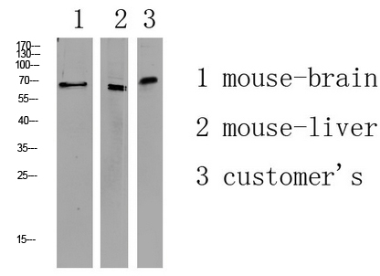Fig1:; Western blot analysis of various lysate, antibody was diluted at 1000. Secondary antibody（catalog#: HA1001) was diluted at 1:20000