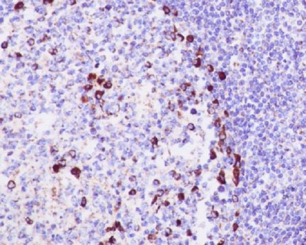 Immunohistochemical analysis of paraffin-embedded human tonsil, using CD9 Antibody.