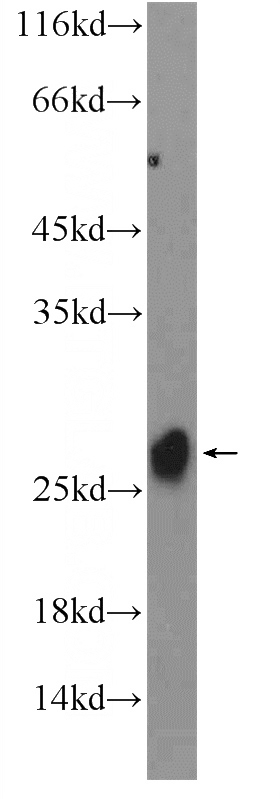 mouse testis tissue were subjected to SDS PAGE followed by western blot with Catalog No:112877(MSRB3 Antibody) at dilution of 1:600
