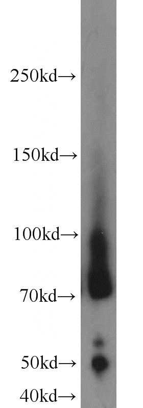 Jurkat cells were subjected to SDS PAGE followed by western blot with Catalog No:112394(LUM antibody) at dilution of 1:800