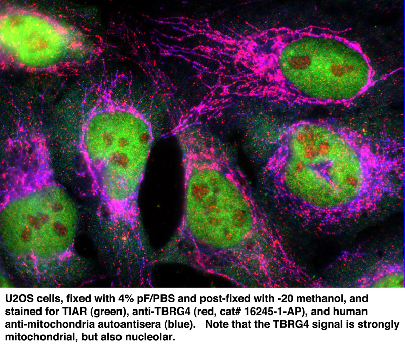 IF result of anti-TBRG4 (Catalog No:115885) with U2OS cells.