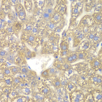 Immunohistochemistry - CYP2C18 Polyclonal Antibody 