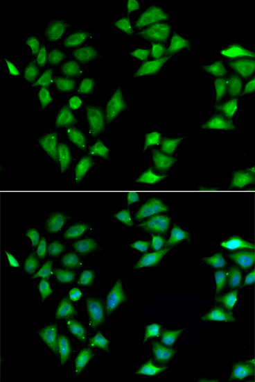 Immunofluorescence - ITLN1 Polyclonal Antibody 