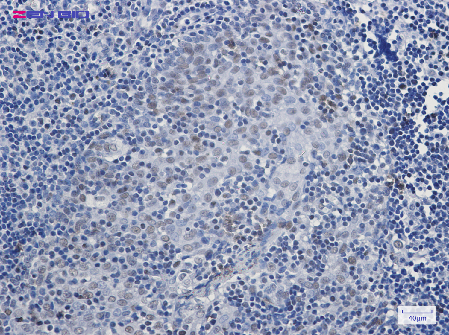 Immunohistochemistry of Chk2 in paraffin-embedded Human tonsil using Chk2 Rabbit pAb at dilution 1/20
