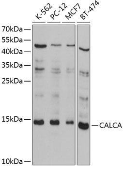 Western blot - CALCA Polyclonal Antibody 
