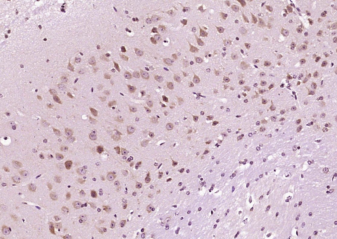 Fig2: Paraformaldehyde-fixed, paraffin embedded (Mouse brain); Antigen retrieval by boiling in sodium citrate buffer (pH6.0) for 15min; Block endogenous peroxidase by 3% hydrogen peroxide for 20 minutes; Blocking buffer (normal goat serum) at 37℃ for 30min; Antibody incubation with (DIO2) Polyclonal Antibody, Unconjugated at 1:400 overnight at 4℃, followed by operating according to SP Kit(Rabbit) (sp-0023) instructionsand DAB staining.
