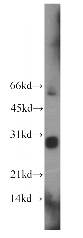 K-562 cells were subjected to SDS PAGE followed by western blot with Catalog No:112231(LIN28 antibody) at dilution of 1:300