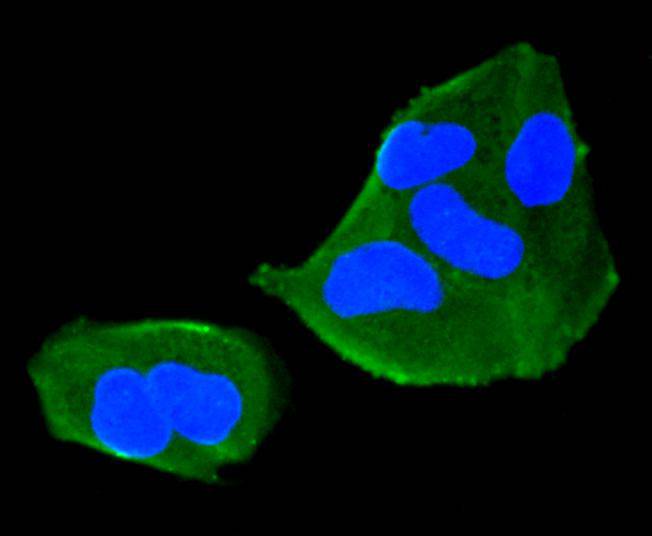 Fig1: Immunocytochemical staining of Hela cells using anti-TMEM39a rabbit polyclonal antibody.