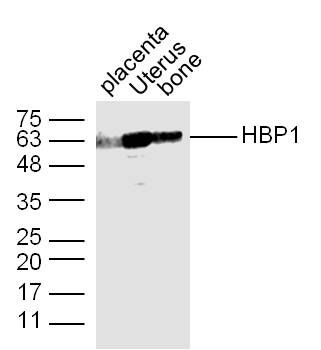 Fig2: Sample:; placenta (mouse) Lysate at 40 ug; Uterus (Mouse) Lysate at 40 ug; bone (Mouse) Lysate at 40 ug; Primary: Anti-HBP1 at 1/300 dilution; Secondary: IRDye800CW Goat Anti-Rabbit IgG at 1/20000 dilution; Predicted band size: 58 kD; Observed band size: 63 kD