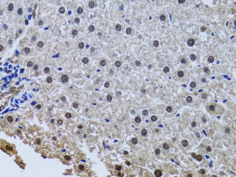 Immunohistochemistry - SIN3A Polyclonal Antibody 