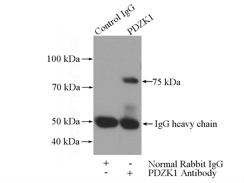 IP Result of anti-PDZK1 (IP:Catalog No:113645, 3ug; Detection:Catalog No:113645 1:500) with HEK-293 cells lysate 3200ug.
