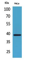 Fig1:; Western Blot analysis of HeLa cells using Bonzo Polyclonal Antibody.. Secondary antibody（catalog#: HA1001) was diluted at 1:20000