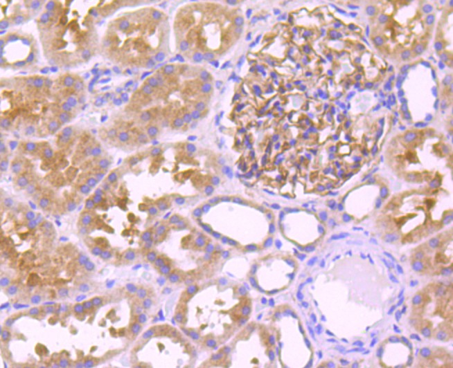 Fig7:; Immunohistochemical analysis of paraffin-embedded human kidney tissue using anti-Leptin Receptor antibody. The section was pre-treated using heat mediated antigen retrieval with Tris-EDTA buffer (pH 8.0-8.4) for 20 minutes.The tissues were blocked in 5% BSA for 30 minutes at room temperature, washed with ddH; 2; O and PBS, and then probed with the primary antibody ( 1/50) for 30 minutes at room temperature. The detection was performed using an HRP conjugated compact polymer system. DAB was used as the chromogen. Tissues were counterstained with hematoxylin and mounted with DPX.