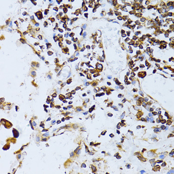 Immunohistochemistry - TAPBP Polyclonal Antibody 