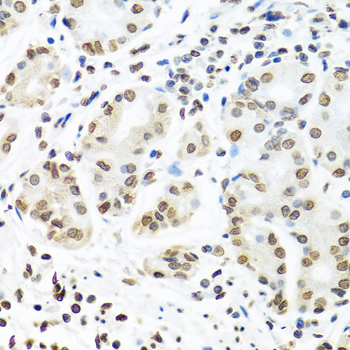 Immunohistochemistry - IGF2BP1 Polyclonal Antibody 