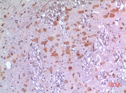Fig2:; Immunohistochemical analysis of paraffin-embedded rat-brain, antibody was diluted at 1:100