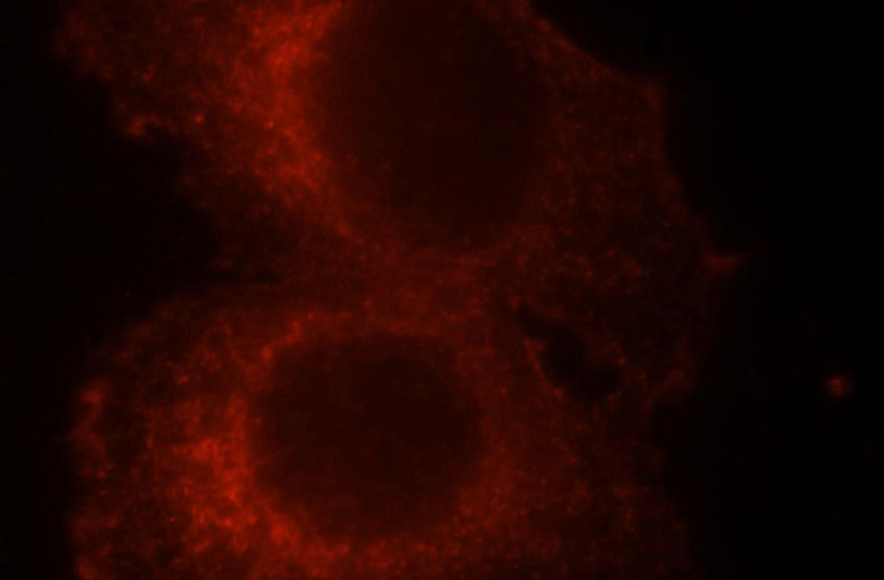 Immunofluorescent analysis of Hela cells, using SocS3 antibody Catalog No:115489 at 1:25 dilution and Rhodamine-labeled goat anti-rabbit IgG (red).