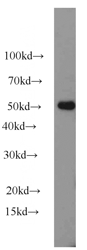mouse bladder tissue were subjected to SDS PAGE followed by western blot with Catalog No:115402(Smtnl1-phospho-S301 antibody) at dilution of 1:500