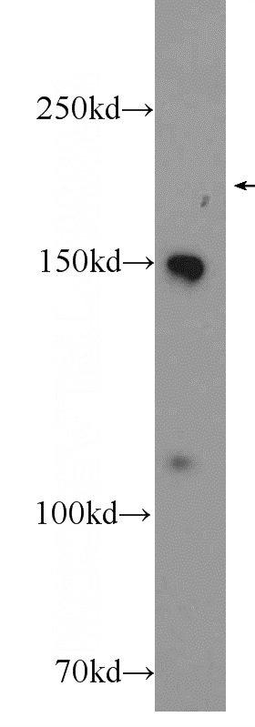 A549 cells were subjected to SDS PAGE followed by western blot with Catalog No:113903(PIK3C2G Antibody) at dilution of 1:600