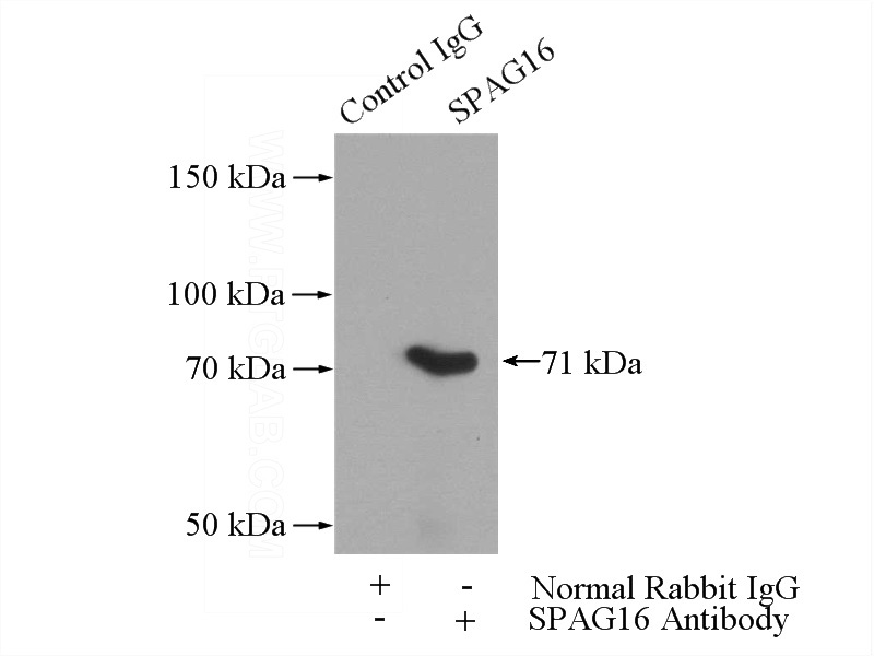 IP Result of anti-SPAG16 (IP:Catalog No:115530, 4ug; Detection:Catalog No:115530 1:1000) with mouse testis tissue lysate 4000ug.