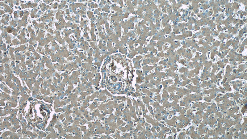 Immunohistochemical of paraffin-embedded human liver using Catalog No:107875(Alpha-1-Antitrypsin antibody) at dilution of 1:50 (under 10x lens)