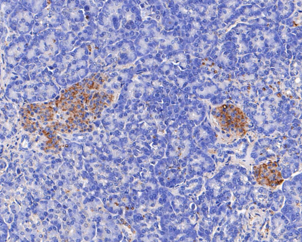 Fig3: Immunohistochemical analysis of paraffin-embedded human pancreas tissue using anti-TRIM72 antibody. The section was pre-treated using heat mediated antigen retrieval with Tris-EDTA buffer (pH 8.0-8.4) for 20 minutes.The tissues were blocked in 5% BSA for 30 minutes at room temperature, washed with ddH2O and PBS, and then probed with the primary antibody ( 1/200) for 30 minutes at room temperature. The detection was performed using an HRP conjugated compact polymer system. DAB was used as the chromogen. Tissues were counterstained with hematoxylin and mounted with DPX.