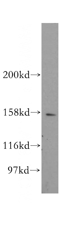 mouse testis tissue were subjected to SDS PAGE followed by western blot with Catalog No:109254(CENPJ antibody) at dilution of 1:500