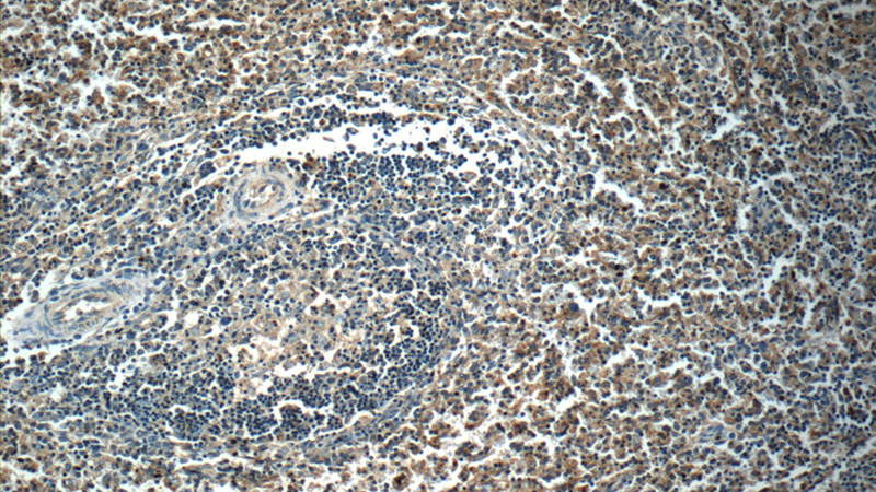 Immunohistochemistry of paraffin-embedded human spleen slide using Catalog No:114778(RocK1-Specific Antibody) at dilution of 1:50