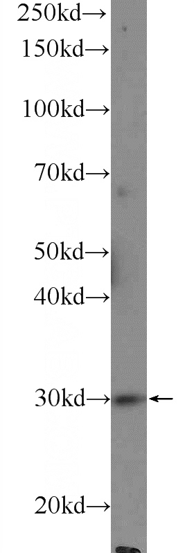 mouse heart tissue were subjected to SDS PAGE followed by western blot with Catalog No:108210(ASB13 Antibody) at dilution of 1:600