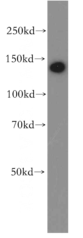 human brain tissue were subjected to SDS PAGE followed by western blot with Catalog No:112598(MGEA5 antibody) at dilution of 1:500