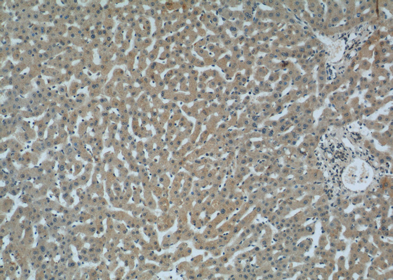 Immunohistochemistry of paraffin-embedded human liver tissue slide using Catalog No:108687(C1QC Antibody) at dilution of 1:50 (under 10x lens)