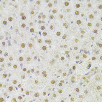 Immunohistochemistry - HDGF Polyclonal Antibody 