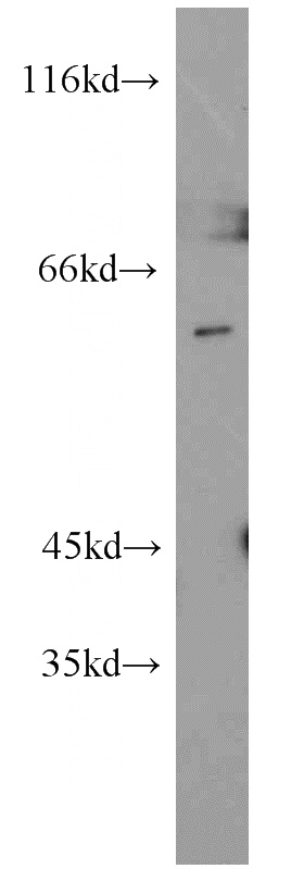 K-562 cells were subjected to SDS PAGE followed by western blot with Catalog No:113410(GNL3 antibody) at dilution of 1:1500