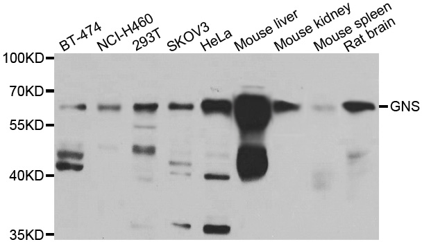 Western blot - GNS Polyclonal Antibody 