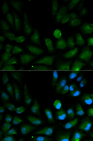 Immunofluorescence - CAPZA2 Polyclonal Antibody 