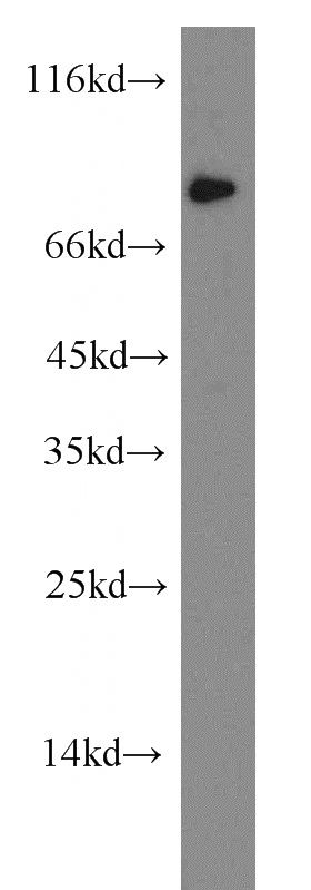 SGC-7901 cells were subjected to SDS PAGE followed by western blot with Catalog No:110385(EFNA4-Specific antibody) at dilution of 1:500