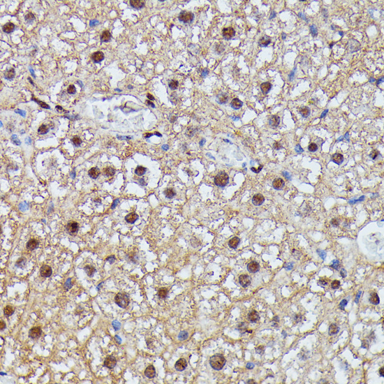 Immunohistochemistry - IGHMBP2 Polyclonal Antibody 