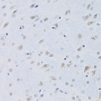 Immunohistochemistry - CBX8 Polyclonal Antibody 