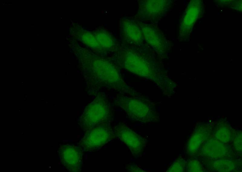 Immunofluorescent analysis of (10% Formaldehyde) fixed HeLa cells using Catalog No:108705(C21orf45 Antibody) at dilution of 1:50 and Alexa Fluor 488-congugated AffiniPure Goat Anti-Rabbit IgG(H+L)