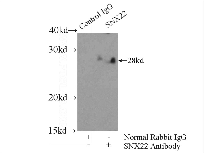 IP Result of anti-SNX22 (IP:Catalog No:115477, 4ug; Detection:Catalog No:115477 1:300) with mouse liver tissue lysate 6400ug.