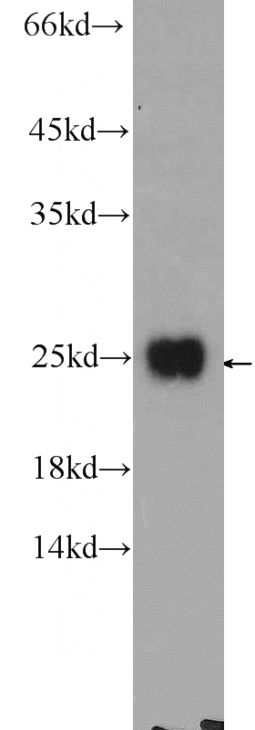 HeLa cells were subjected to SDS PAGE followed by western blot with Catalog No:108963(CCDC12 Antibody) at dilution of 1:600