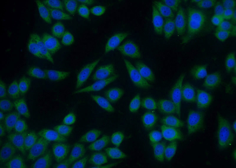 Immunofluorescent analysis of HeLa cells using Catalog No:117142(BID Antibody) at dilution of 1:50 and Alexa Fluor 488-congugated AffiniPure Goat Anti-Rabbit IgG(H+L)