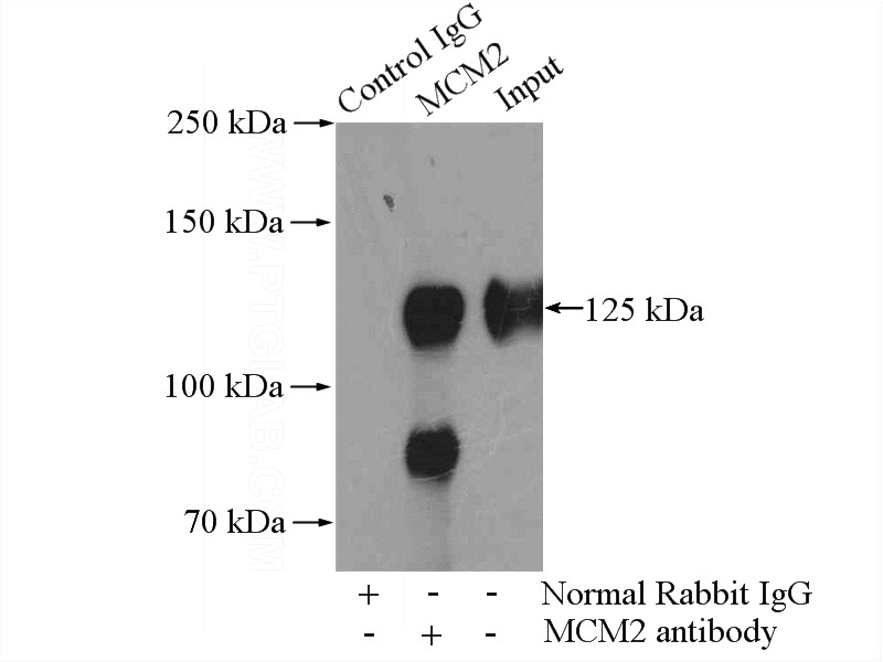 IP Result of anti-MCM2 (IP:Catalog No:112552, 4ug; Detection:Catalog No:112552 1:800) with HEK-293 cells lysate 2800ug.