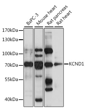 Western blot - KCND1 Polyclonal Antibody 