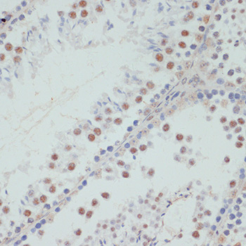 Immunohistochemistry - Phospho-PEA15-S104 pAb 