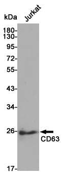 Western blot detection of CD63 in Jurkat cell lysates using CD63 rabbit pAb (1:500 diluted).Predicted band size:26kDa.Observed band size:26kDa.