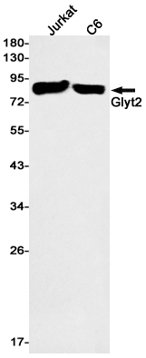 Western blot detection of Glyt2 in Jurkat,C6 cell lysates using Glyt2 Rabbit mAb(1:1000 diluted).Predicted band size:87kDa.Observed band size:87kDa.