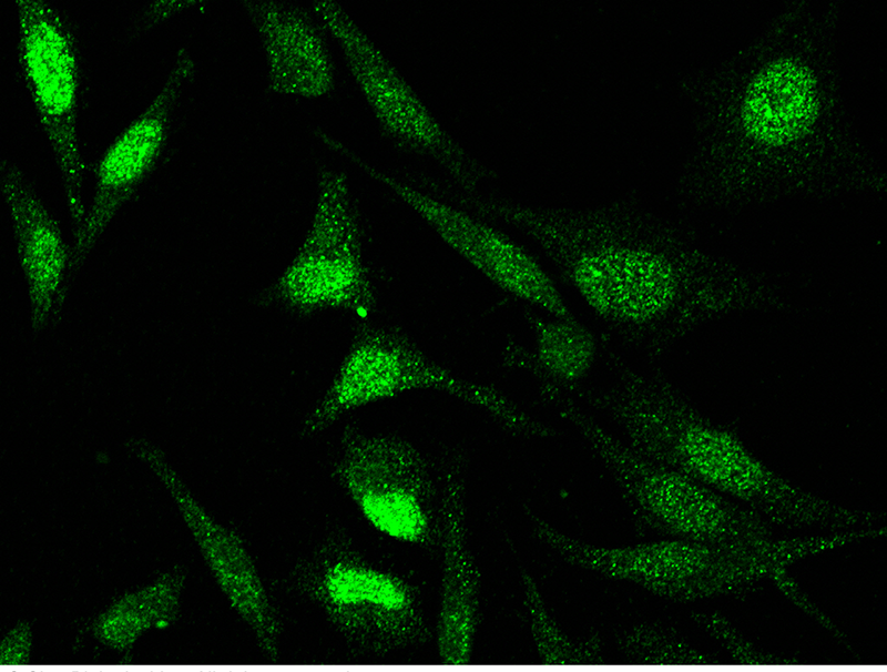 Human Survivin/BIRC5/API4 Immunofluorescence(IF) 14693