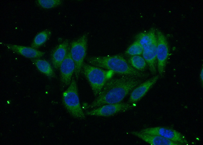 Immunofluorescent analysis of (-20oc Ethanol) fixed HeLa cells using Catalog No:115086(SEC61B Antibody) at dilution of 1:50 and Alexa Fluor 488-congugated AffiniPure Goat Anti-Rabbit IgG(H+L)